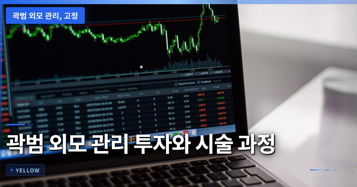 곽범의 외모 관리 비법: 고정 8개 프로그램 출연과 수천만 원 투자 과정
